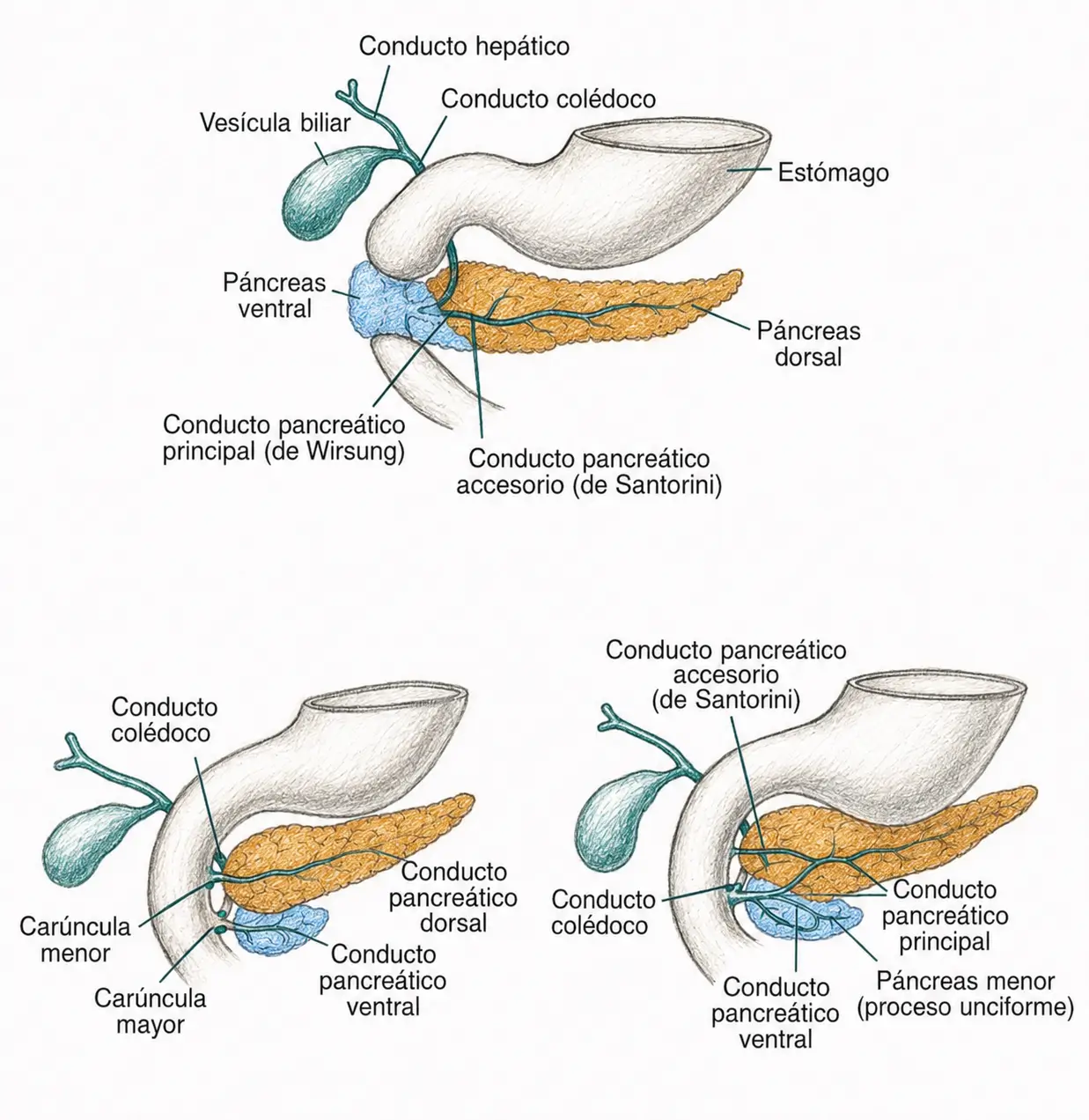 Ilustración embriológica de la fusión de los esbozos pancreáticos ventral y dorsal y de la formación de los conductos de Wirsung y Santorini.
