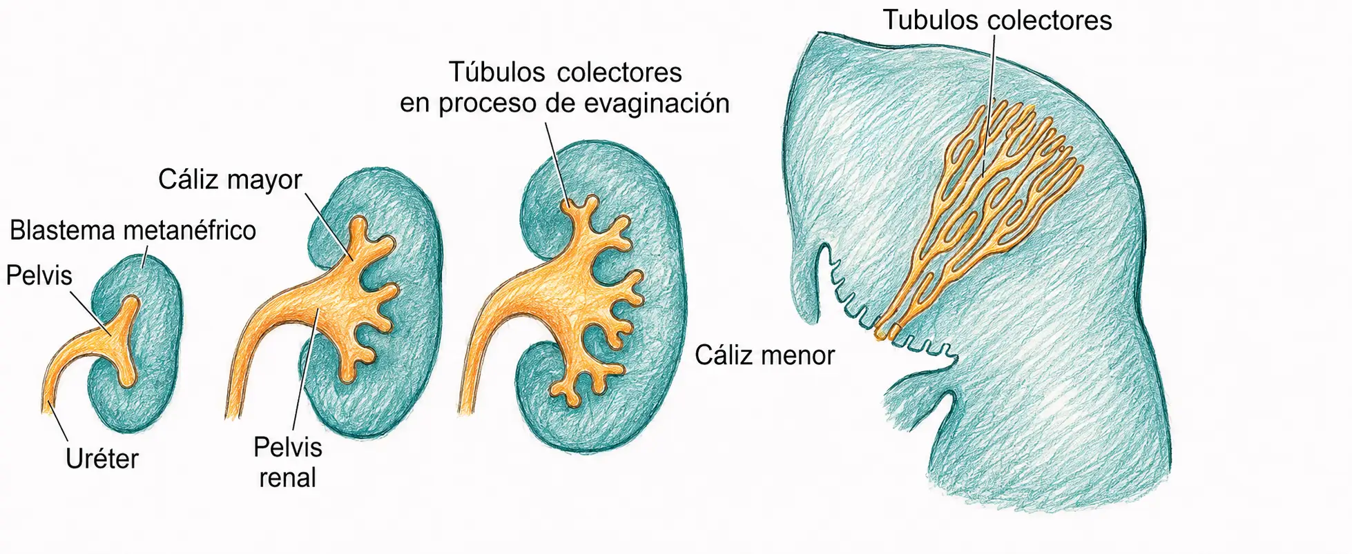 Ilustración secuencial del desarrollo del uréter, pelvis renal, cálices mayores y menores y túbulos colectores dentro del blastema metanéfrico.