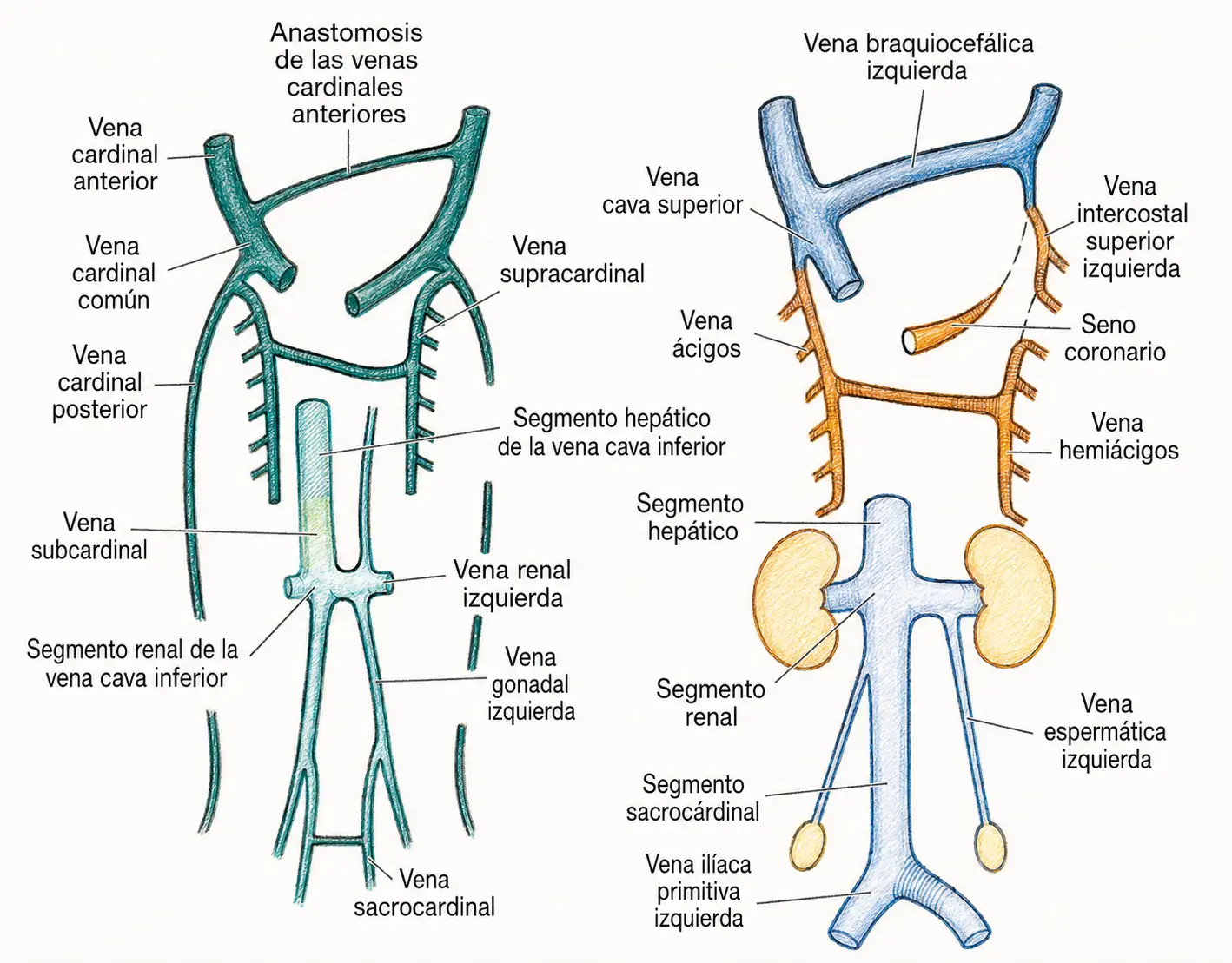 Ilustración de la formación de la vena cava inferior a partir de sus segmentos hepático, renal y sacrocardinal, con relación con la vena ácigos y la vena cava superior.