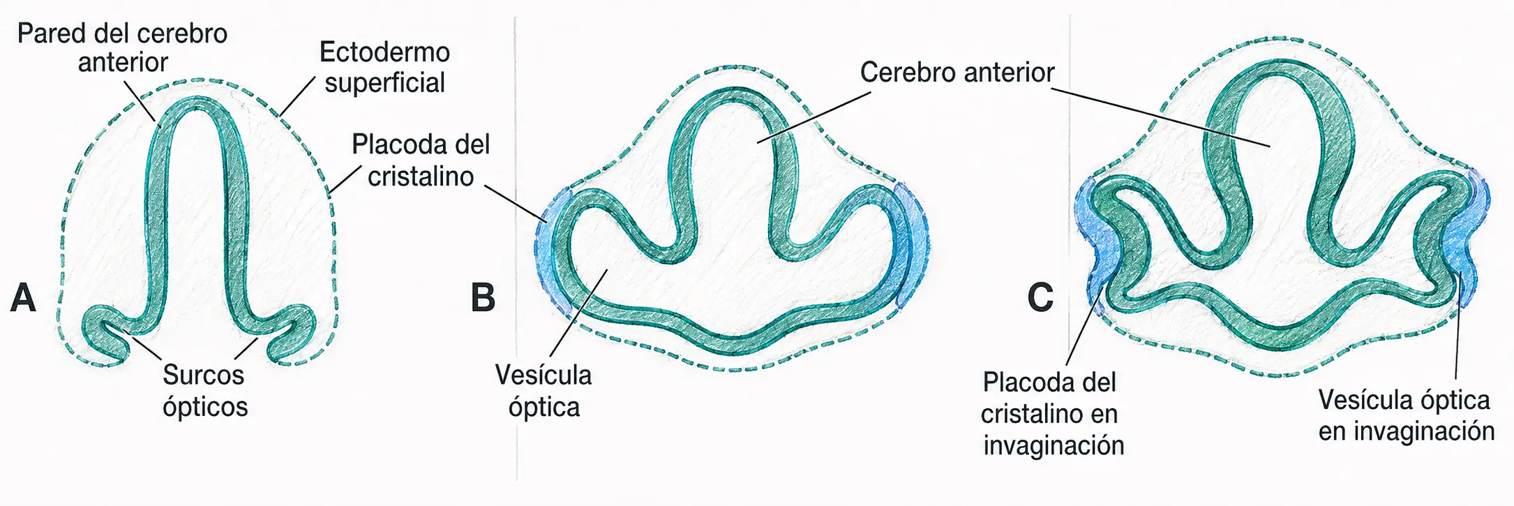 Ilustración embriológica de la formación de la vesícula óptica y la inducción de la placoda del cristalino a partir del cerebro anterior y el ectodermo superficial.