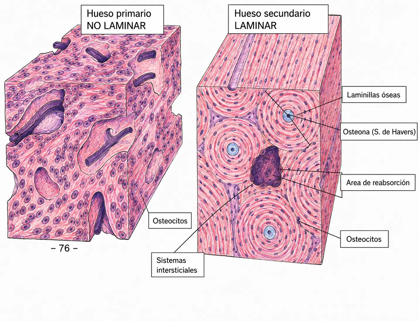 Comparación histológica entre hueso primario no laminar y hueso secundario laminar, con osteocitos, laminillas óseas, osteonas, sistemas intersticiales y área de reabsorción.