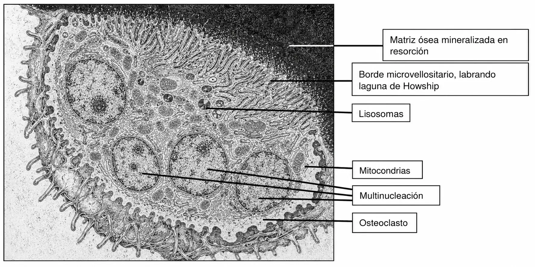 Ultraestructura del osteoclasto mostrando la multinucleación, el borde microvellositario fruncido labrando la laguna de Howship, los lisosomas y las mitocondrias