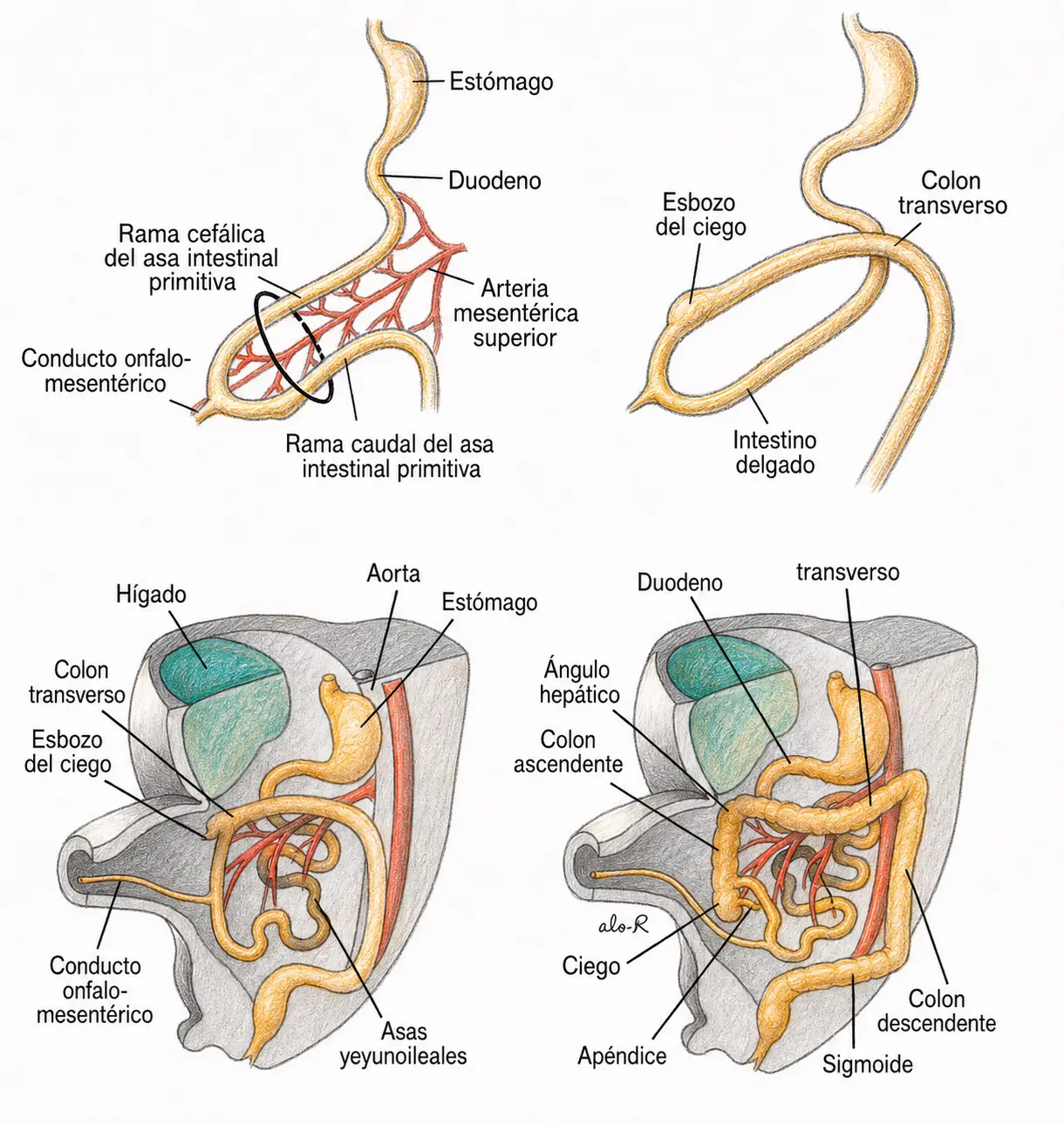 Ilustración en cuatro etapas de la rotación del intestino medio alrededor de la arteria mesentérica superior y la formación del intestino delgado y colon.