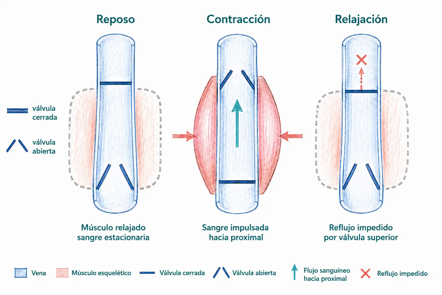 Esquema de la bomba muscular esquelética en reposo, contracción y relajación, mostrando la apertura y cierre de las válvulas venosas y el impulso de la sangre hacia proximal